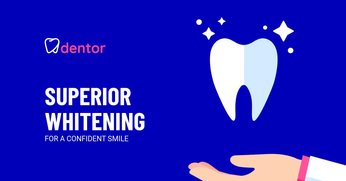 Superior Whitening for a Confident Smile-1200x628px-FacebookSponsoredMessage