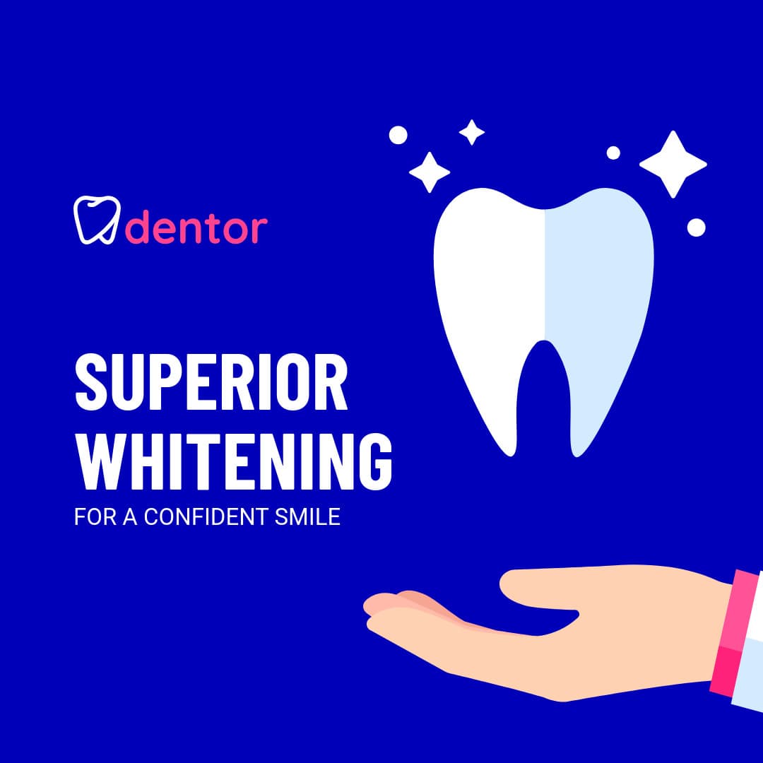 Superior Whitening for a Confident Smile-1080x1080px-InstagramPost