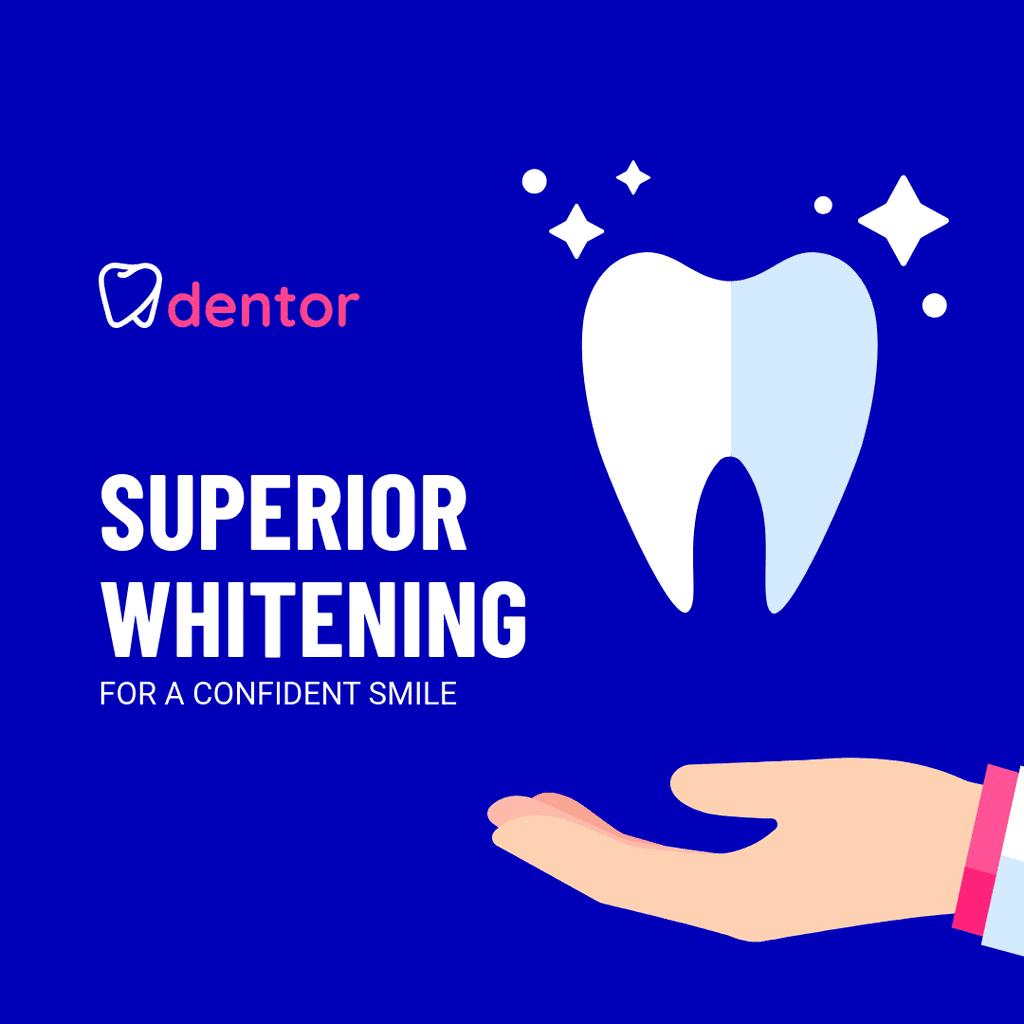Superior Whitening for a Confident Smile Instagram Post